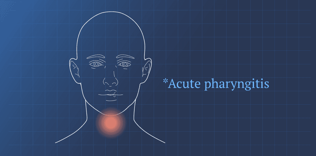 Acute pharyngitis or cobblestone throat location pain